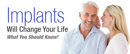 Implants