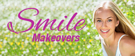 Smile Makeovers